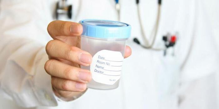 Una maggiore quantità di lubrificante è un motivo per consultare un medico e sottoporsi al test